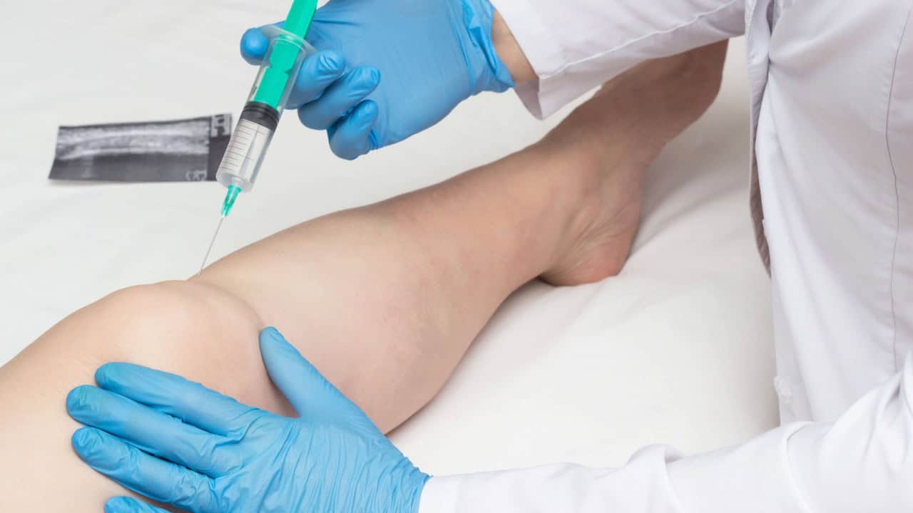 Proloterapi SGK Karşılıyor Mu