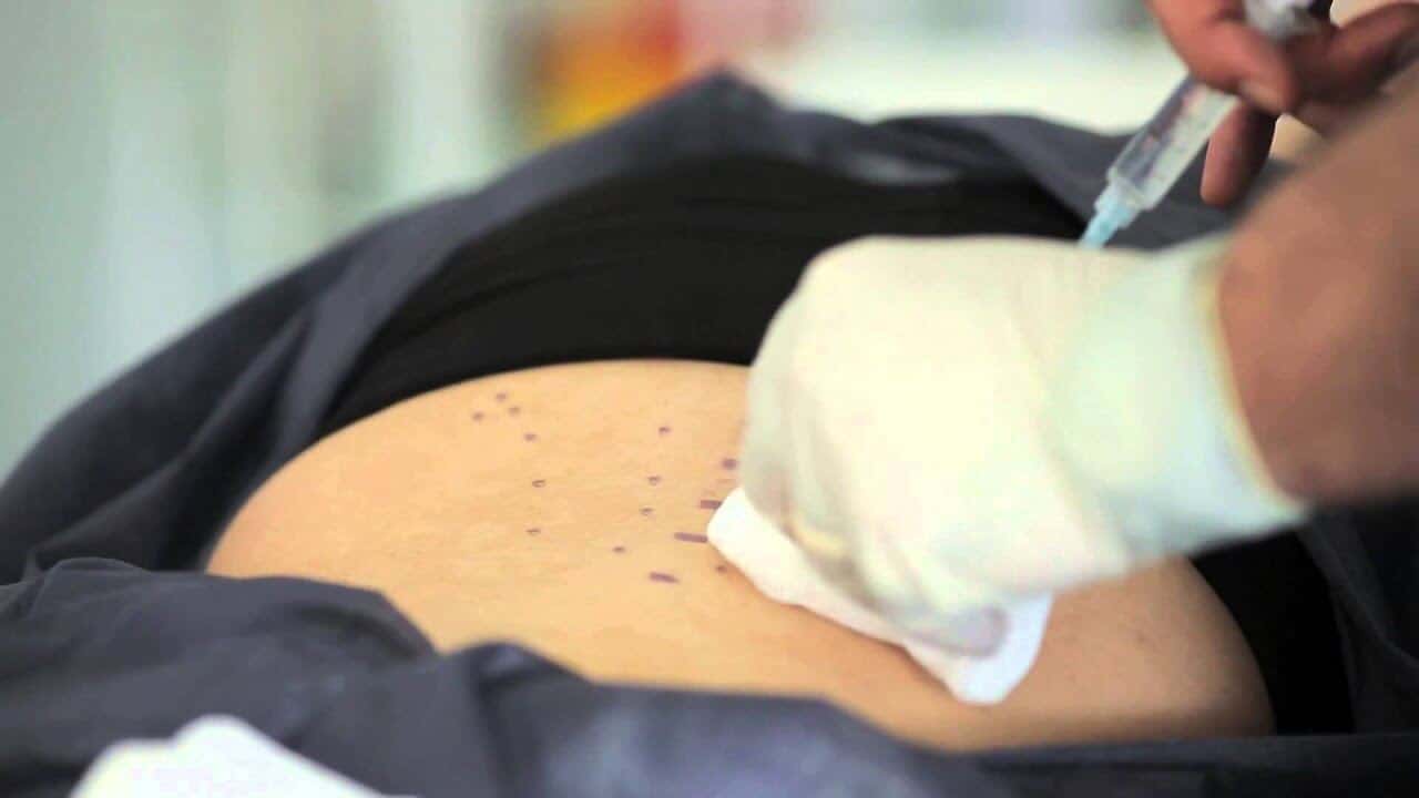 Proloterapi SGK Karşılıyor Mu